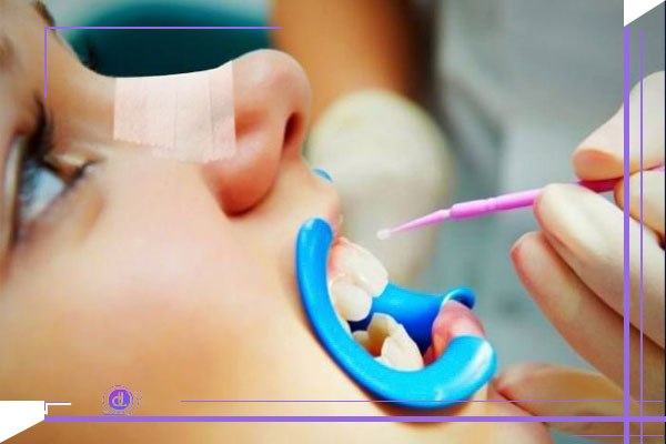 دندانپزشکی بعد از جراحی بینی