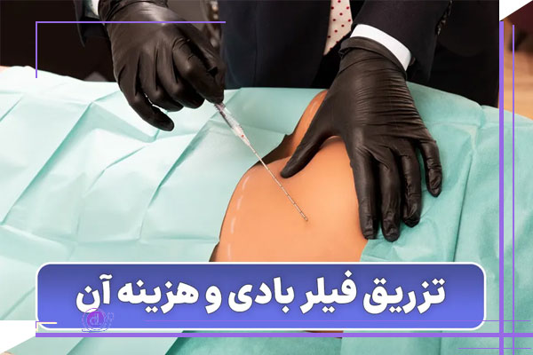 بهترین ناحیه‌ های قابل تزریق فیلر بادی