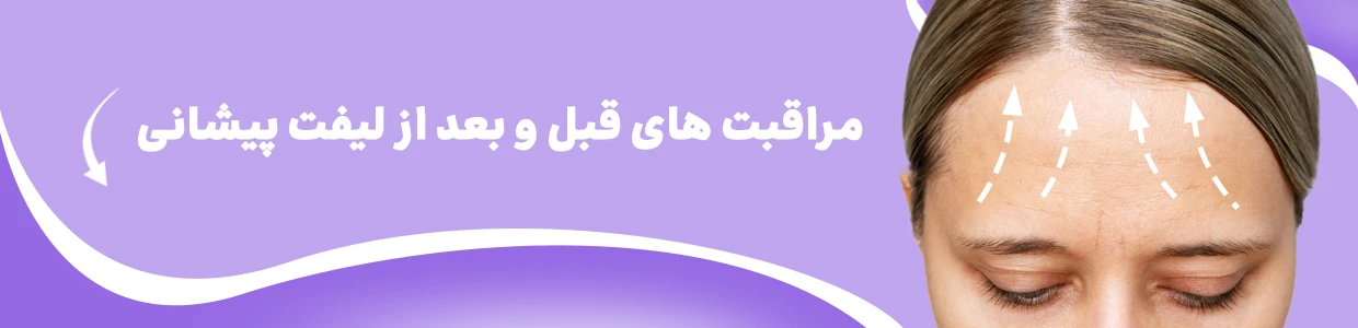 لیفت پیشانی