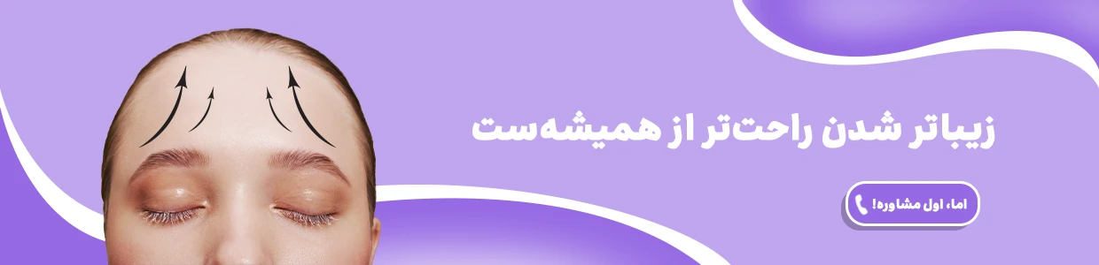 لیفت پیشانی