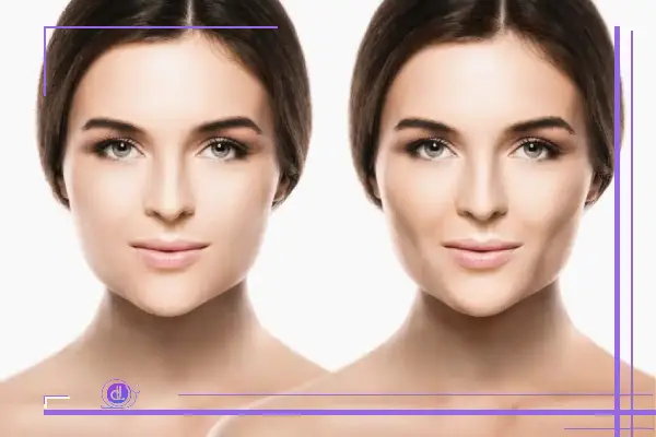 تأثیر کاهش وزن بر بوکال 