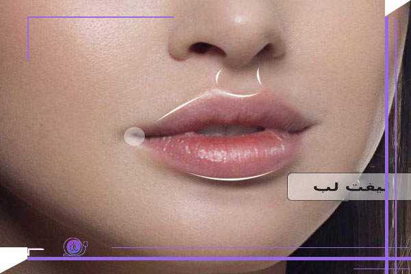 مقایسه سانترال لب و فیلر لب