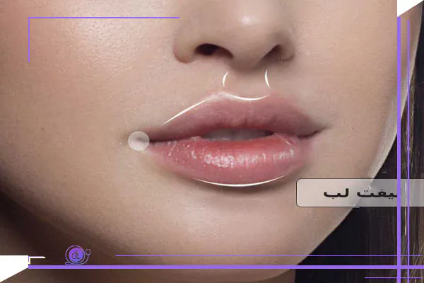 مقایسه سانترال لب و فیلر لب