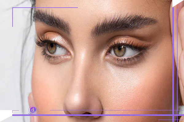 بوتاکس شقیقه