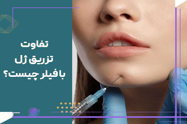 تفاوت ژل و فیلر