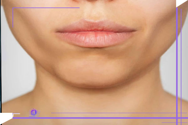 ساختار و عملکرد چربی بوکال در صورت: نقش آن در فرم‌دهی چهره