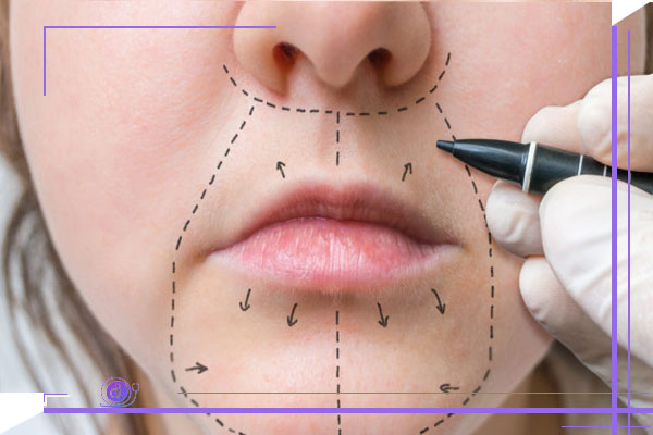 روش های جدید جراحی سانترال لب
