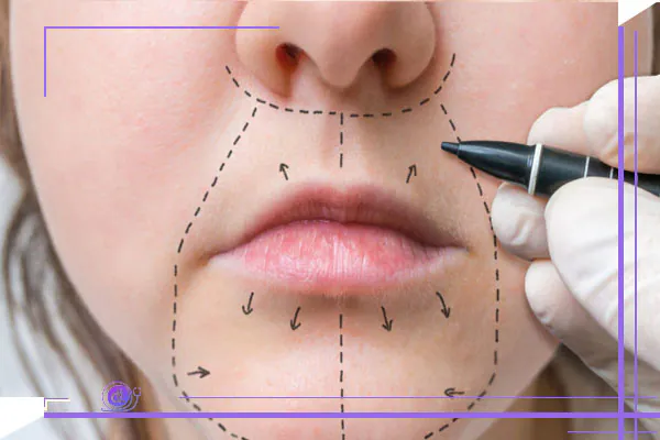 روش های جدید جراحی سانترال لب