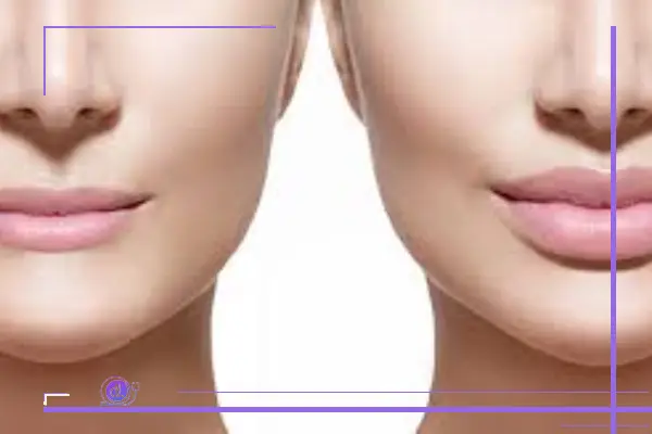 جایگزین جراحی سانترال