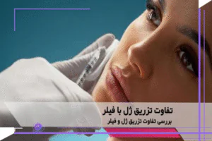 مقایسه ماندگاری ژل و فیلر