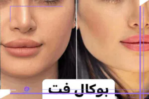 ساختار و عملکرد چربی بوکال در صورت: نقش آن در فرم‌دهی چهره