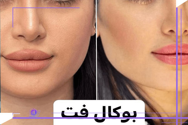 ساختار و عملکرد چربی بوکال در صورت: نقش آن در فرم‌دهی چهره