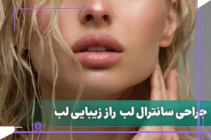 سانترال لب و تأثیر آن بر زیبایی صورت