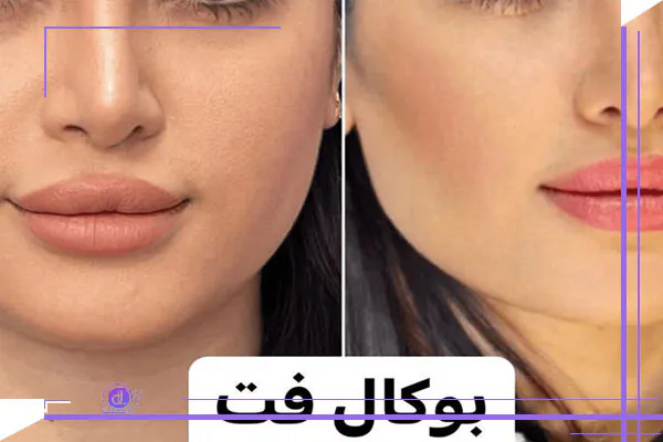 توصیه‌ های مهم قبل از جراحی بوکال فت: راهنمای جامع آمادگی پیش از عمل