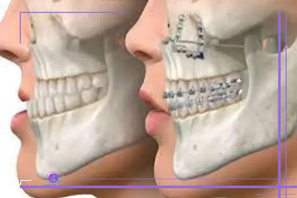 جراحی فک در شیراز