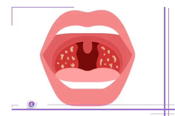 جراحی لوزه در شیراز