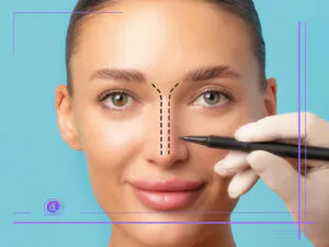 جراحی بینی با قالب کنترلی در شیراز