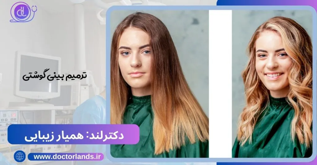 عمل بینی ترمیمی؛ فرصتی دوباره برای زیبایی عمل بینی ترمیمی؛ فرصتی دوباره برای زیبایی