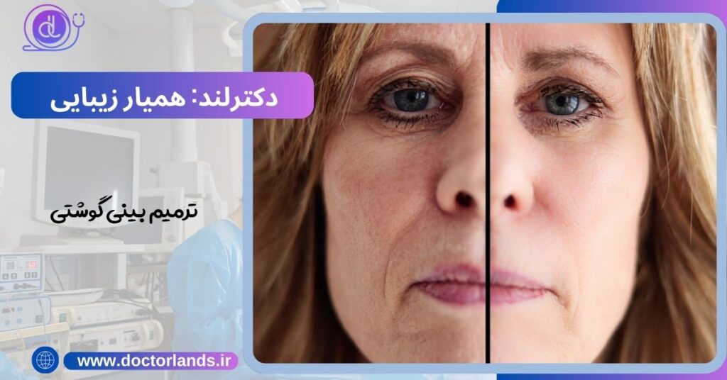 ترمیم بینی گوشتی