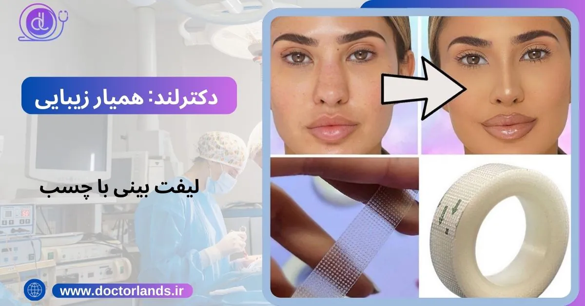 لیفت بینی | لیفت بینی با نخ + مزایا و معایب لیفت بینی + هزینه ها لیفت بینی با چسب