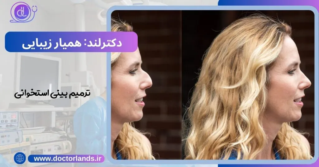 عمل بینی ترمیمی؛ فرصتی دوباره برای زیبایی ترمیم بینی استخوانی