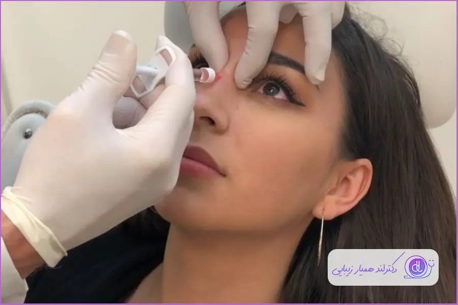 کوچک کردن بینی گوشتی | راهکارهای غیرجراحی و ایمن مزایای تزریق آنزیم به بینی گوشتی