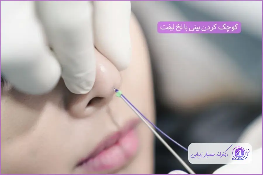 کوچک کردن بینی گوشتی | راهکارهای غیرجراحی و ایمن اصلاح بینی گوشتی با لیفت بینی با نخ
