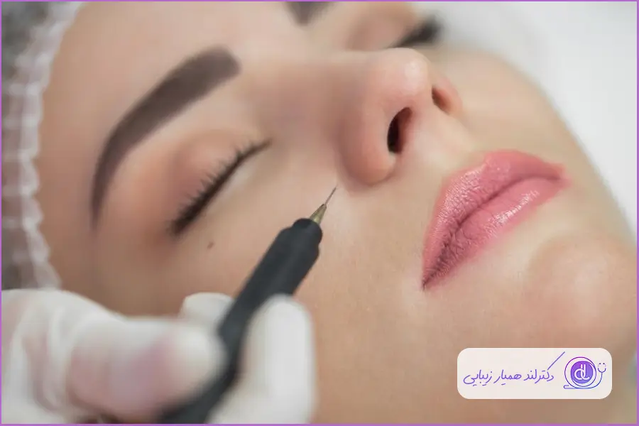 کوچک کردن بینی گوشتی | راهکارهای غیرجراحی و ایمن درمان بینی گوشتی با پلاسما جت