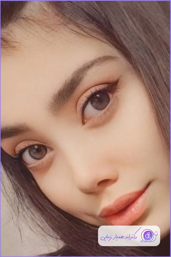 نمومه کار جراحی بینی به سبک نیمه فانتزی دکتر غزال نوروزی