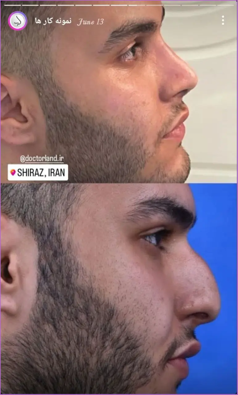نمونه کار های پزشکان دکترلند در پیج اینستاگرام