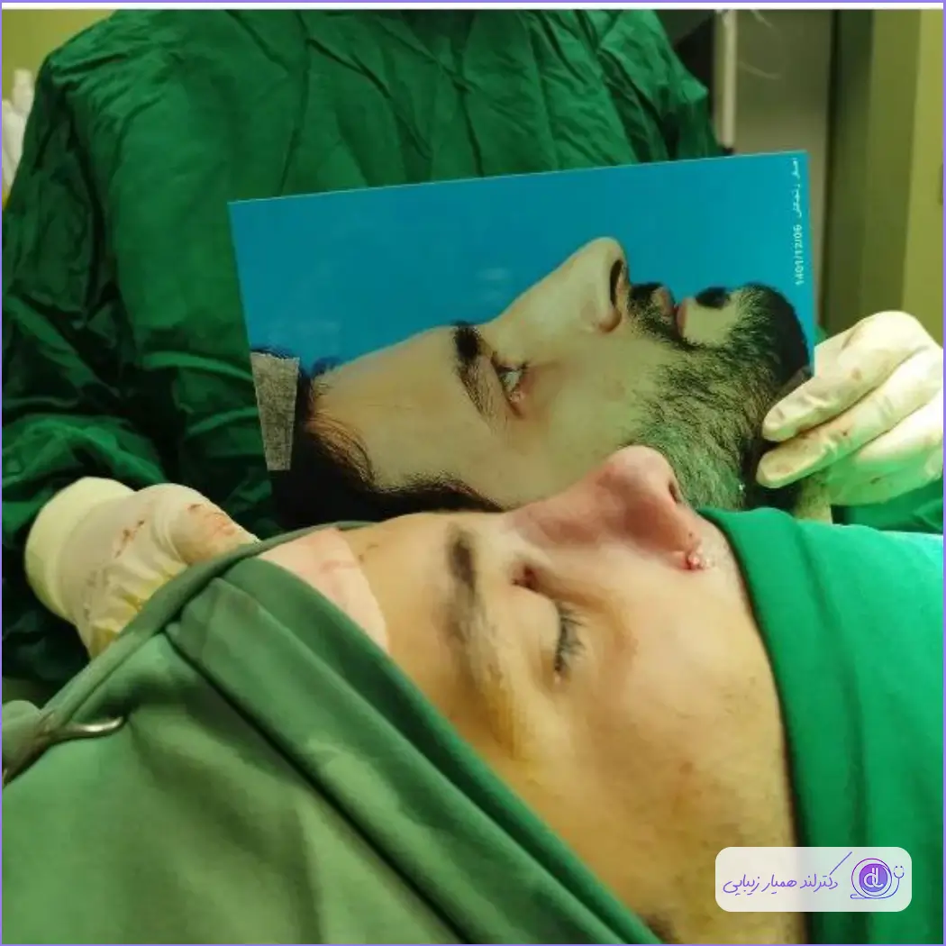 جراحی دماغ استخوانی مردانه دکتر نفیسه صادق زاده