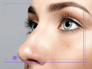 جراحی بینی با لیزر در شیراز