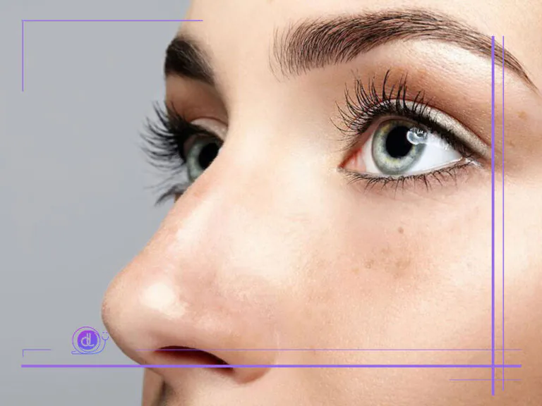 جراحی بینی با لیزر در شیراز