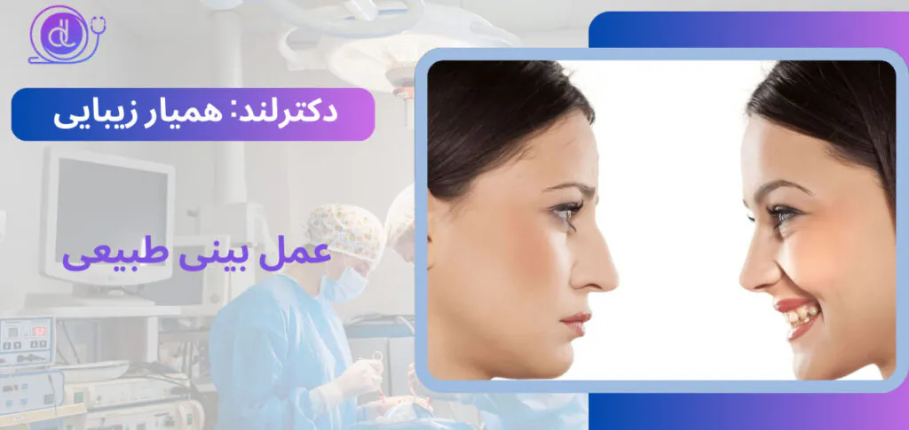 عمل بینی طبیعی از ۰ تا ۱۰۰ | معرفی بهترین جراحان بینی طبیعی عمل بینی طبیعی-1