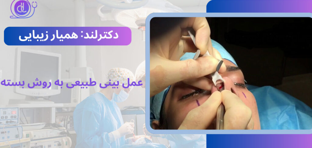 عمل بینی طبیعی-3
