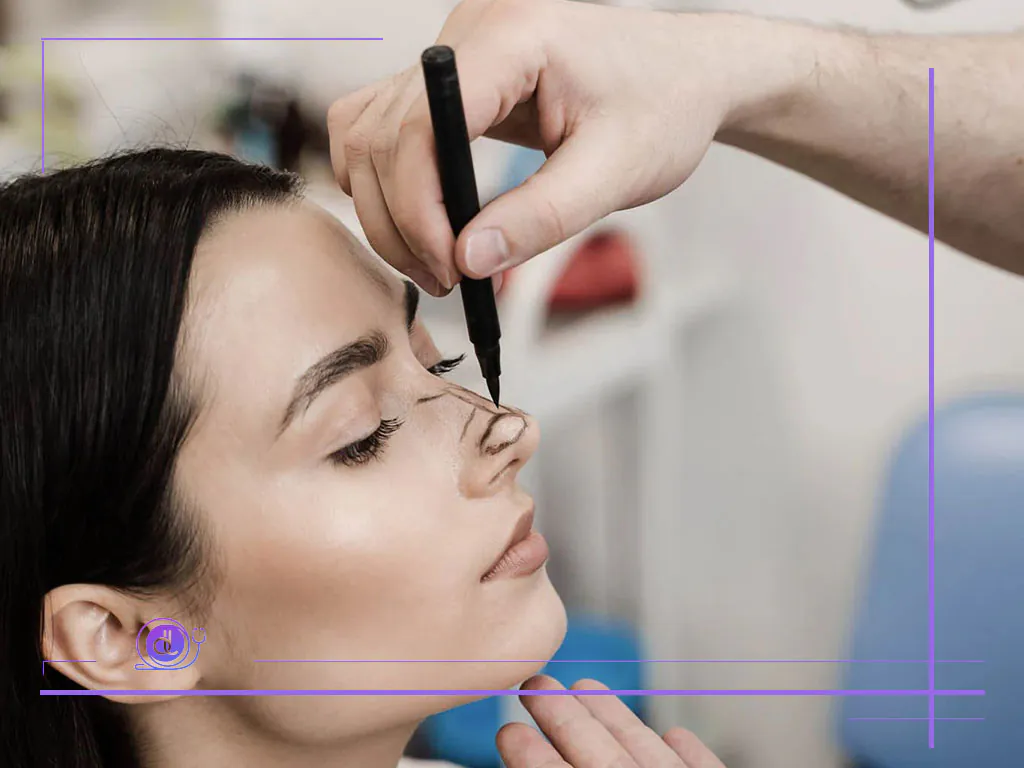 عمل بینی قسطی در شیراز: شرایط، هزینه و معرفی بهترین پزشکان عمل بینی قسطی در شیراز-4