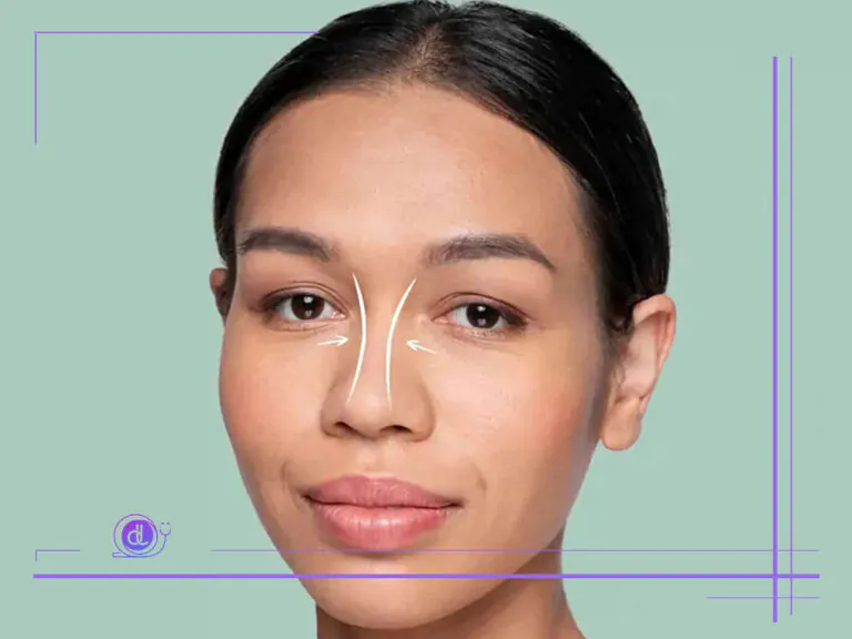 عمل بینی گوشتی