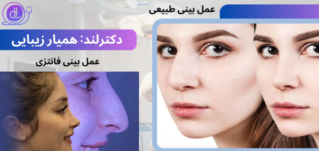 عمل بینی طبیعی از ۰ تا ۱۰۰ | معرفی بهترین جراحان بینی طبیعی عمل بینی طبیعی-5