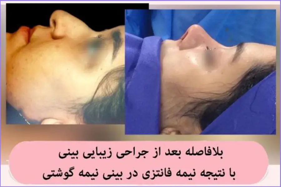 بهترین جراح بینی در اصفهان ۱۴۰۴ + لیست ۱۰ پزشک برتر بهترین جراح بینی در اصفهان-دکتر اصغر نریمانی