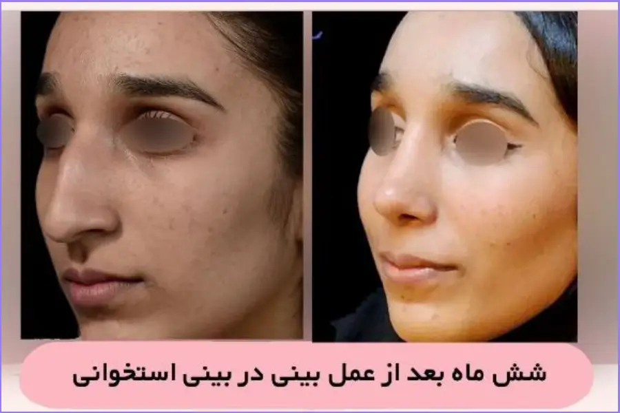 بهترین جراح بینی در اصفهان ۱۴۰۴ + لیست ۱۰ پزشک برتر بهترین جراح بینی در اصفهان-دکتر علی اصغر نریمانی