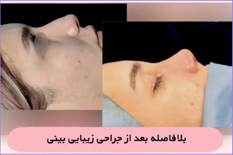 بهترین جراح بینی در اصفهان ۱۴۰۴ + لیست ۱۰ پزشک برتر بهترین جراح بینی در اصفهان-دکتر علی اصغر نریمانی-2