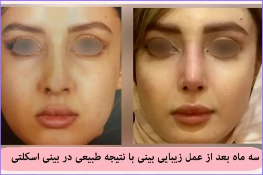 بهترین جراح بینی در اصفهان ۱۴۰۴ + لیست ۱۰ پزشک برتر بهترین جراح بینی در اصفهان-دکتر علی اصغر نریمانی-3