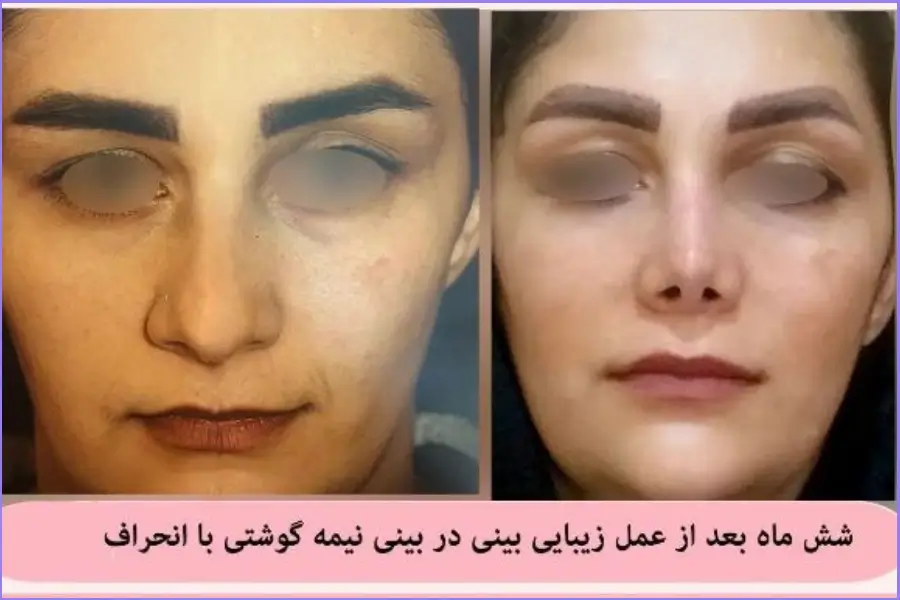 بهترین جراح بینی در اصفهان ۱۴۰۴ + لیست ۱۰ پزشک برتر بهترین جراح بینی در اصفهان-دکتر علی اصغر نریمانی-6