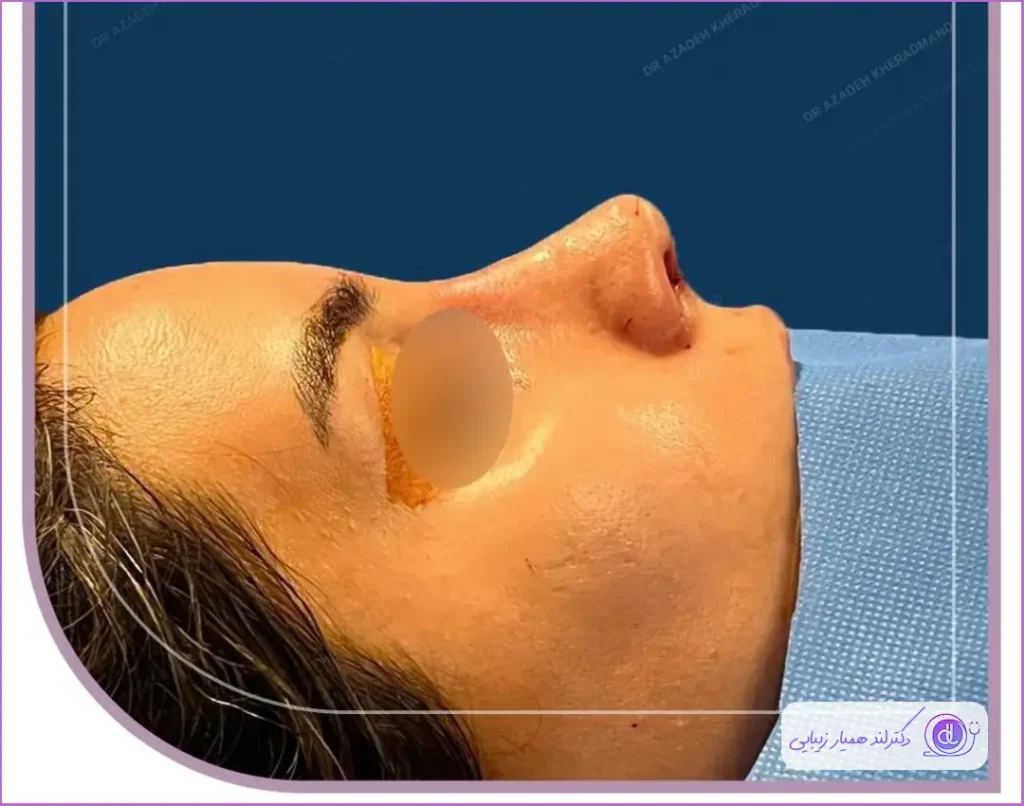 بهترین جراح بینی در اصفهان ۱۴۰۴ + لیست ۱۰ پزشک برتر بهترین جراح بینی در اصفهان ۱۴۰۴ + لیست ۱۰ پزشک برتر