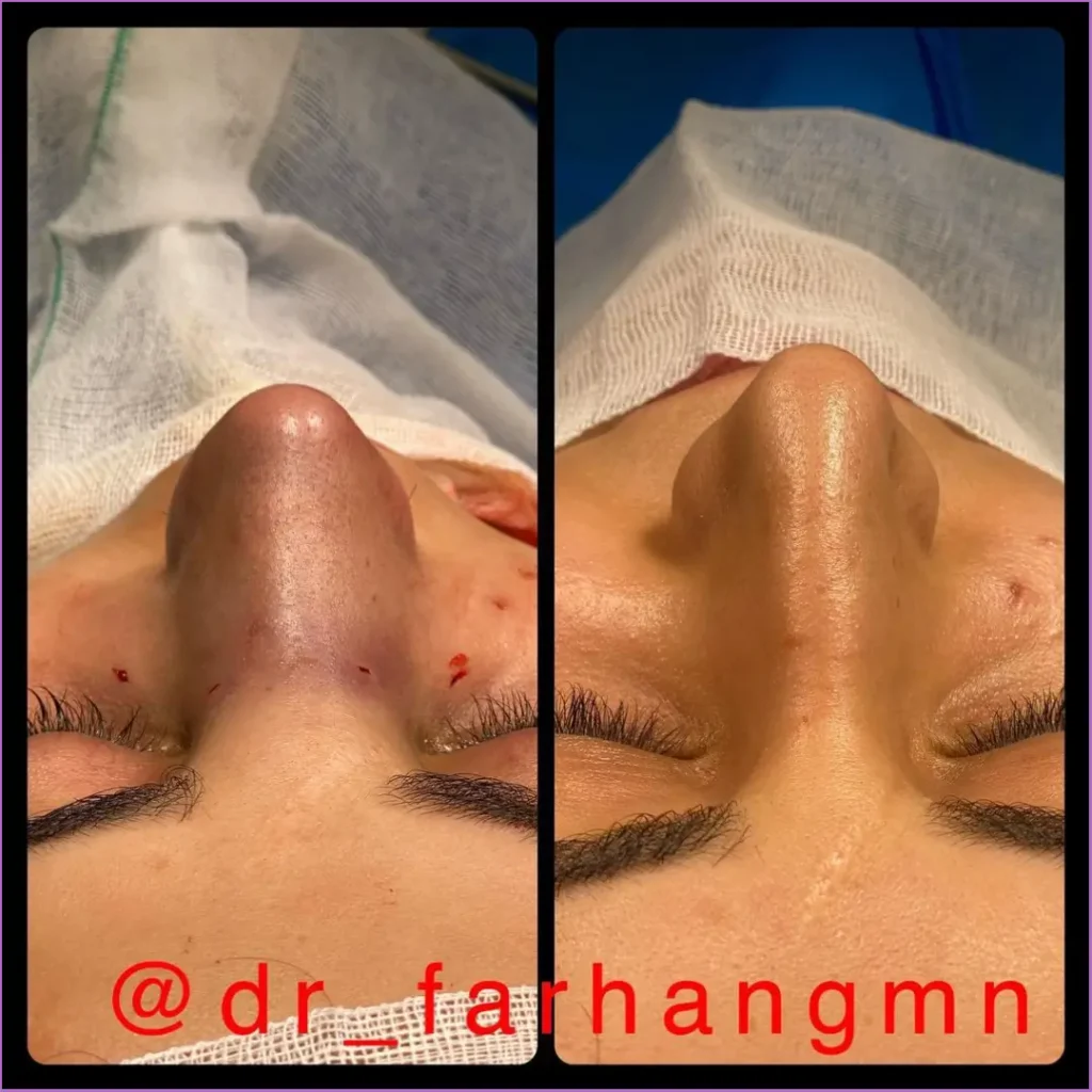 بهترین جراح بینی در اصفهان ۱۴۰۴ + لیست ۱۰ پزشک برتر بهترین جراح بینی در اصفهان-دکتر فرهنگ مختاری زاده-6