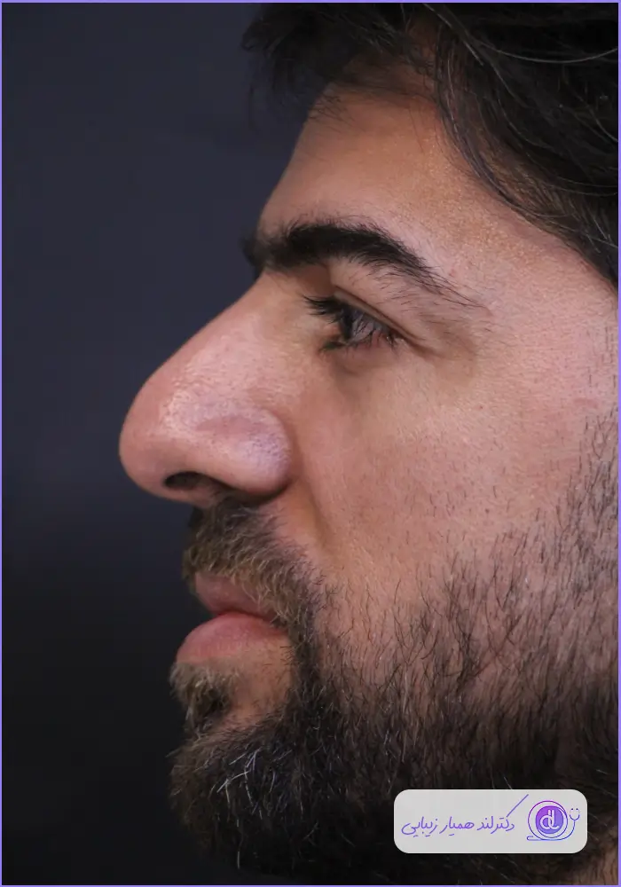 بهترین جراح انحراف بینی در تهران | معرفی ۵ پزشک متخصص سپتوپلاستی بهترین جراح انحراف بینی در تهران | معرفی ۵ پزشک متخصص سپتوپلاستی
