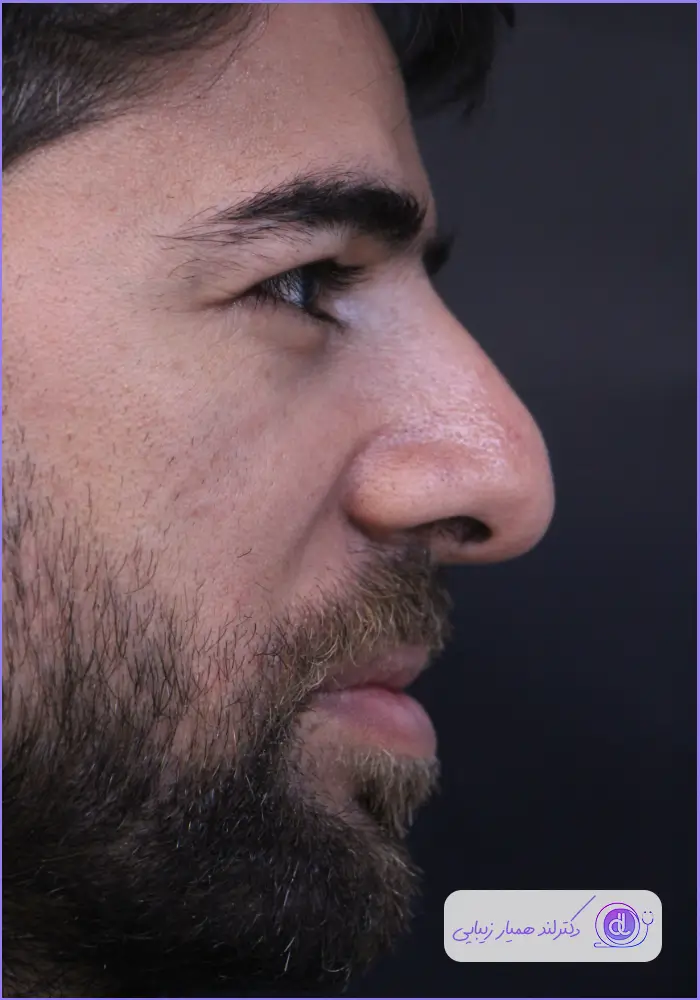 بهترین جراح انحراف بینی در تهران | معرفی ۵ پزشک متخصص سپتوپلاستی بهترین جراح انحراف بینی در تهران | معرفی ۵ پزشک متخصص سپتوپلاستی