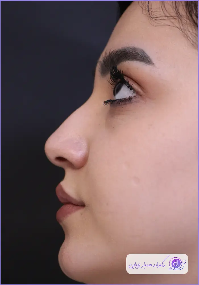 بهترین جراح انحراف بینی در تهران | معرفی ۵ پزشک متخصص سپتوپلاستی بهترین جراح انحراف بینی در تهران | معرفی ۵ پزشک متخصص سپتوپلاستی