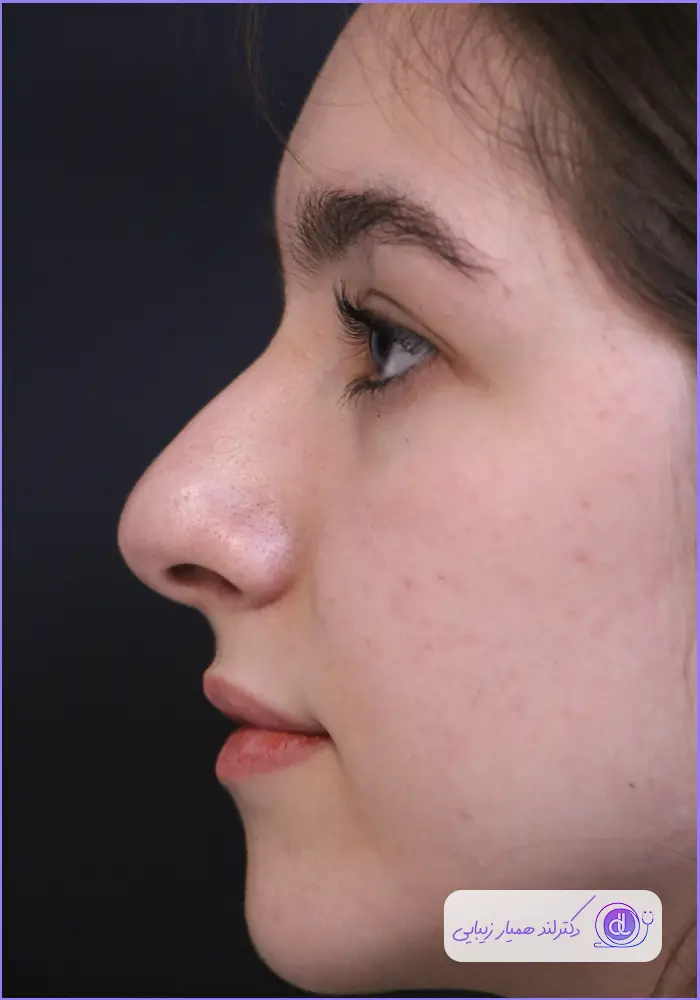 بهترین جراح بینی طبیعی در تهران | معرفی 5 پزشک برتر + هزینه و نمونهکار بهترین جراح بینی طبیعی در تهران-3