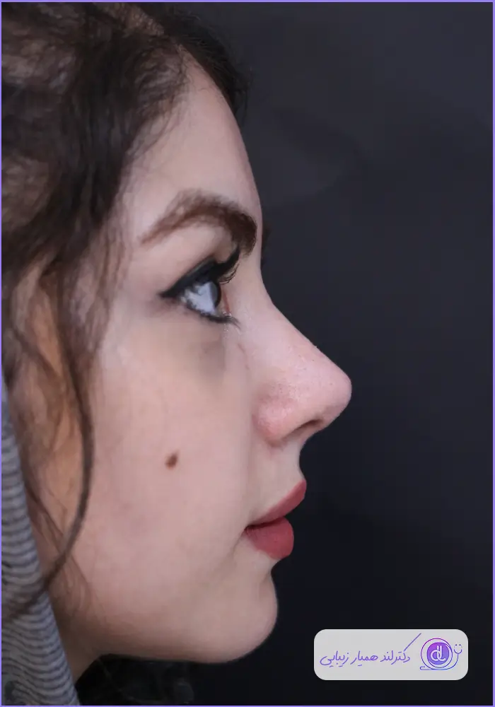 بهترین جراح بینی طبیعی در تهران | معرفی 5 پزشک برتر + هزینه و نمونهکار بهترین جراح بینی طبیعی در تهران-2